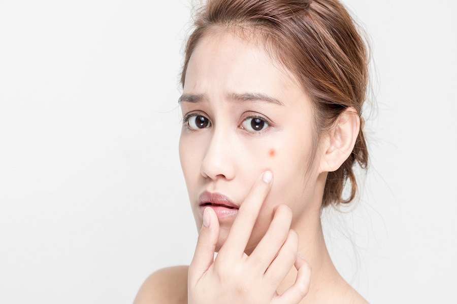 Rửa mặt với sản phẩm có độ pH phù hợp là cách chăm sóc da mặt bị mụn và nhờn