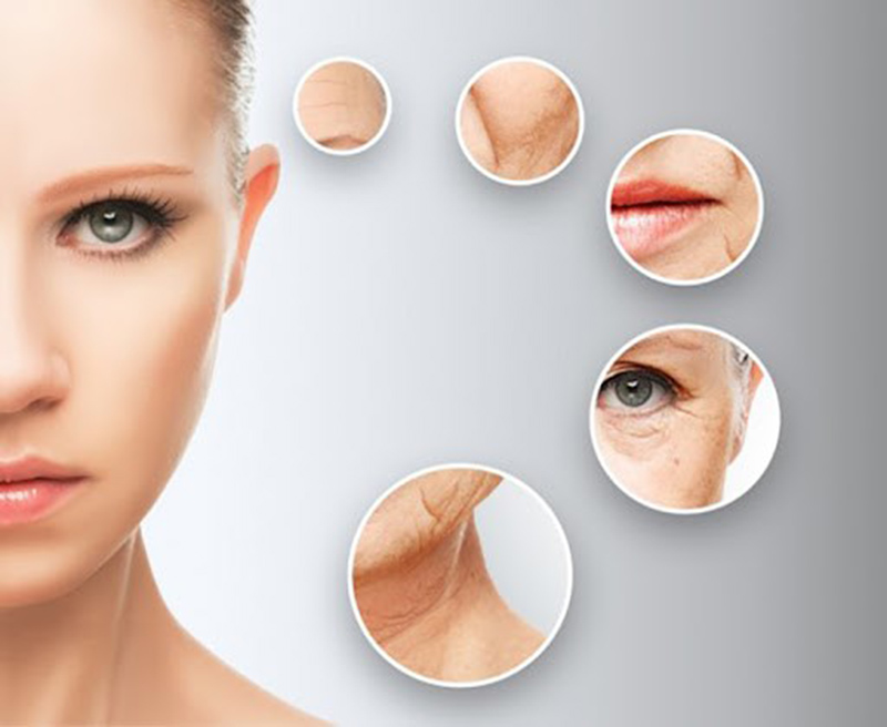 Căng chỉ collagen giúp bạn loại bỏ các khuyết điểm của da