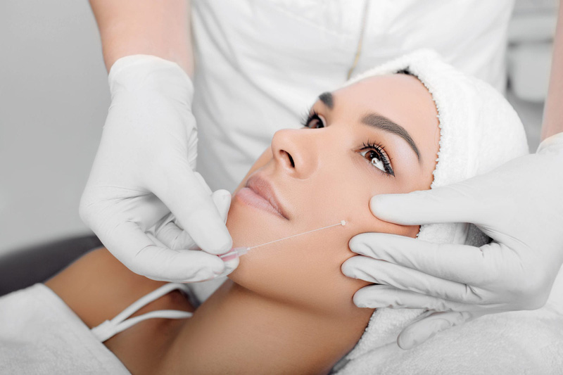 Căng da mặt bằng chỉ collagen là phương pháp làm đẹp an toàn với làn da