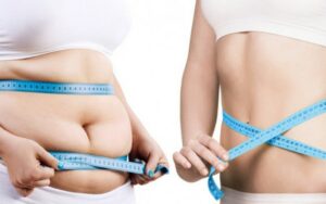 So với các vùng khác thì giảm béo vùng bụng thường có giá cao hơn