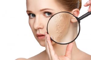 Nếu làn da khô không được chăm sóc đúng cách nó rất dễ xuất hiện các bệnh lý về da