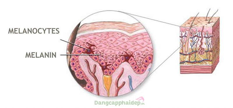 Melanin quyết định sắc tố da. Melanin sản sinh nhiều sẽ gây sậm màu da.