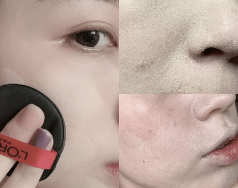 Có nhiều nguyên dân dẫn đến tình trạng da bị mốc sau khi makeup