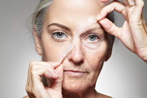 Ưu điểm của căng chỉ collagen là khắc phục tình trạng chảy xệ của làn da