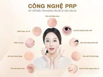 Prp là giải pháp làm đẹp hiệu quả được ưa chuộng