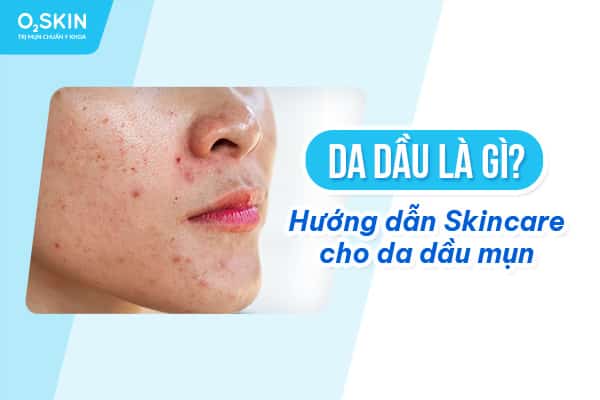 Da dầu là gì? Hướng dẫn Skincare cho da dầu mụn