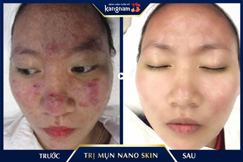 da mặt khô ngứa mẩn đỏ