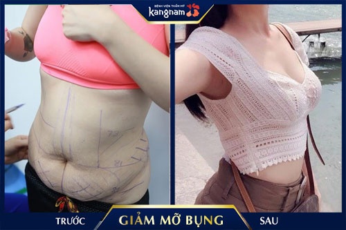 cách làm giảm mỡ bụng cho dân văn phòng