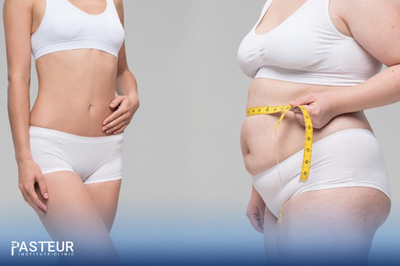 Giảm mỡ toàn thân được hiểu là giảm mỡ toàn bộ các vùng tích tụ chất béo trên cơ thể