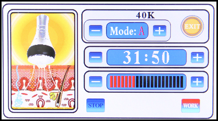 Công nghệ Cavitation 40.000Hz máy giảm béo BD-20