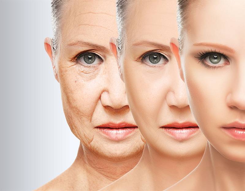 Những người từ 30-50 tuổi da bị chảy xệ, chùng nhão các vùng trên gương mặt có thể sử dụng căng chỉ collagen