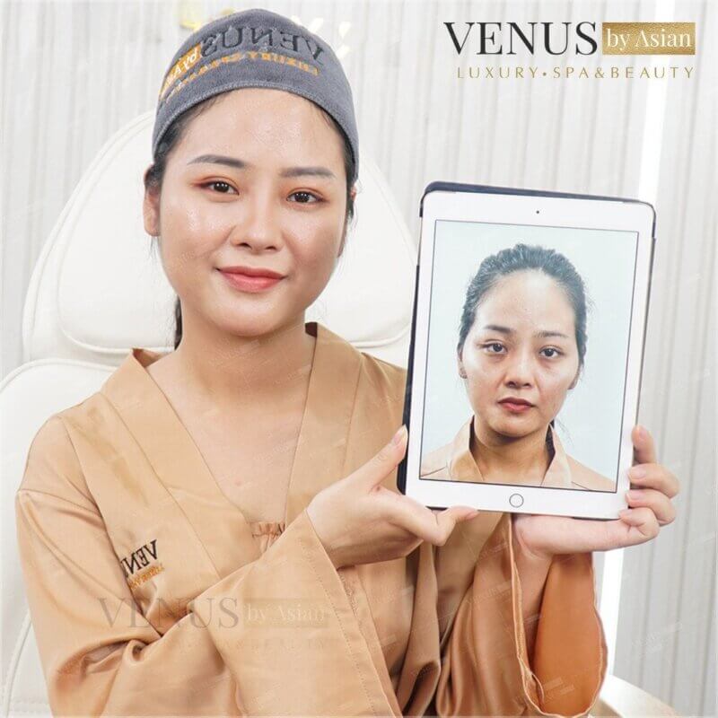 Khách hàng đến với Phòng khám Venus by Asian