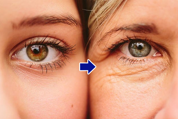 Hiệu quả trước và sau khi dùng kem dưỡng mắt thường xuyên