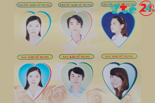 Review Bạch Hoa Hồng từ người dùng