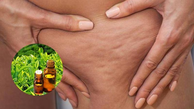 Trà xanh hỗ trợ điều trị bệnh da vỏ cam