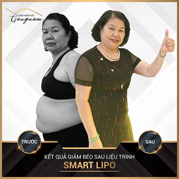 Cô Tâm (66 tuổi) giảm mỡ máu, tiểu đường sau khi giảm cân thành công với Smart Lipo