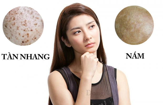 Kem trị tàn nhang Ốc Sên