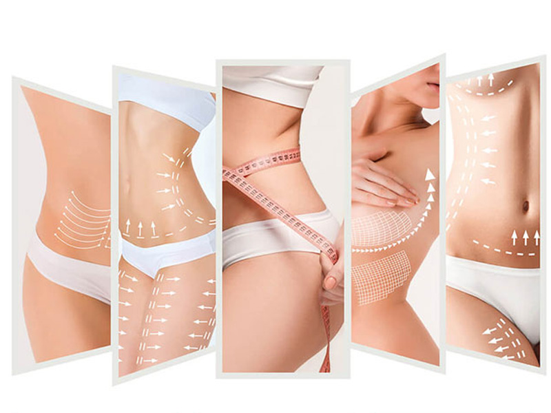 Công nghệ Ultra Slim thành công xoá mỡ các vùng bụng, eo, mông,...