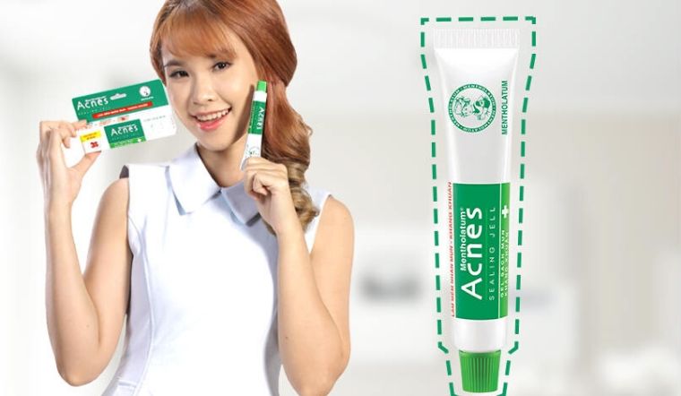 Kem trị mụn Acnes có tốt không