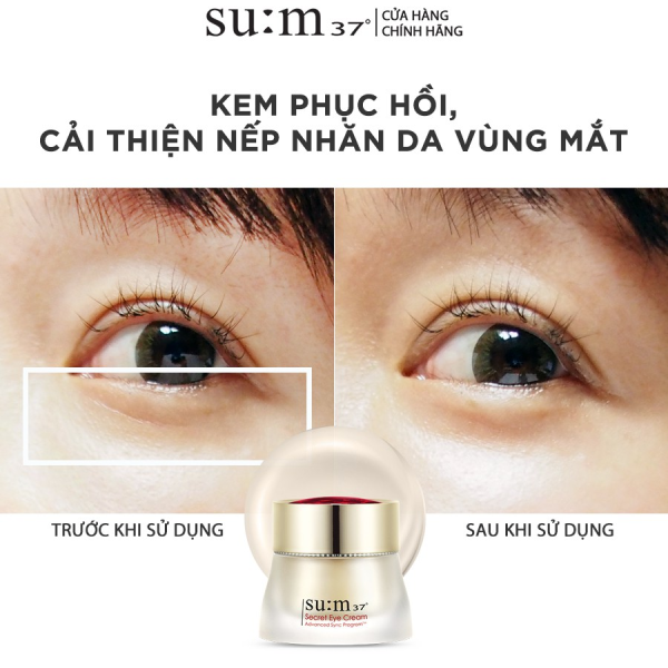 mỹ phẩm Su:m37