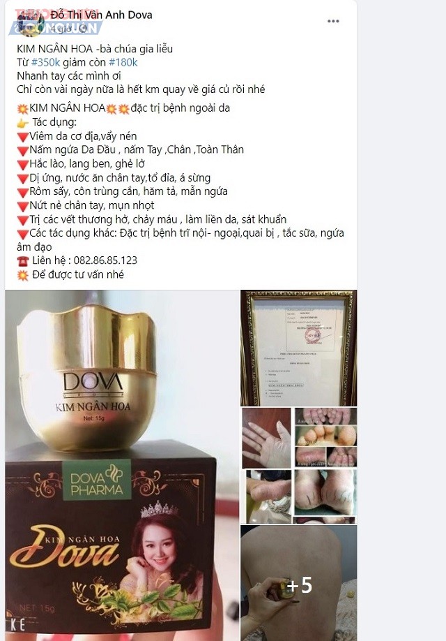 Trên trang facebook Đỗ Thị Vân Anh Dova, có quảng cáo sản phẩm “KIM NGÂN HOA -bà chúa da liễu”