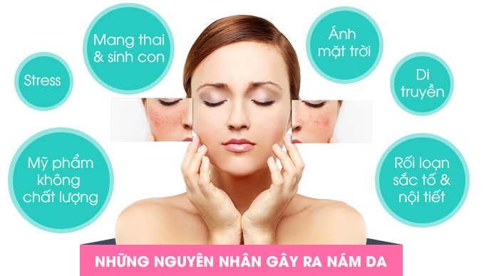 nguyen_nhan_gay_ra_nam_da