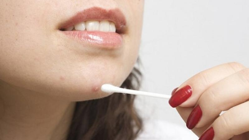 Dùng lưu huỳnh 5 để trị những loại mụn nào?