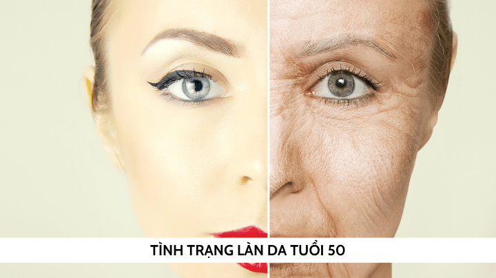 Tình trạng làn da tuổi cần sử dụng kem dưỡng da cho người trên 50 tuổi