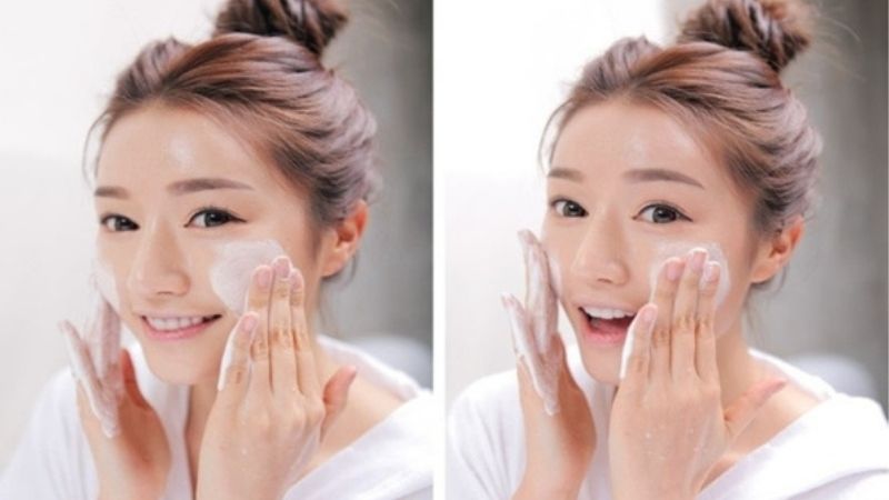 Urea tẩy tế bào chết